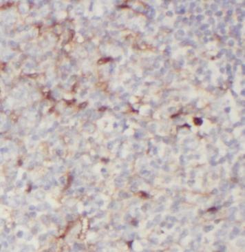 anti- CLEC9A antibody