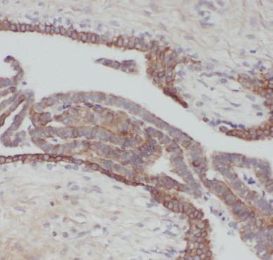 anti- Cytokeratin 18 antibody