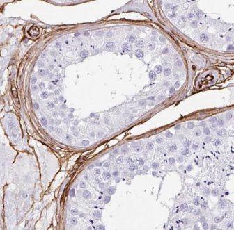 anti- EMB antibody