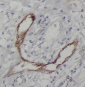 anti- Endoglin/CD105 antibody