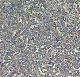 anti- FERMT3 antibody