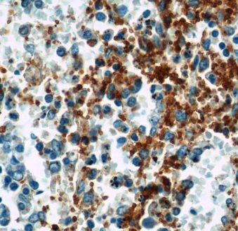 anti- GP9 antibody