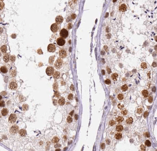 anti- GPR123-Specific antibody