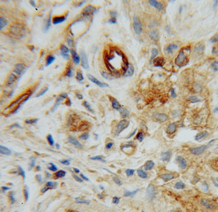 anti- HRH1 antibody