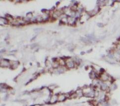 anti- HSP60 antibody