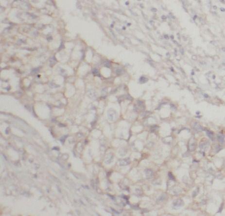 anti- ICAM-1 antibody