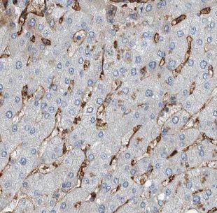 anti- IGFBP7 antibody