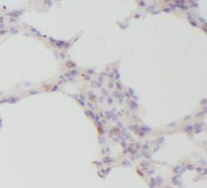 anti- IL1 beta antibody