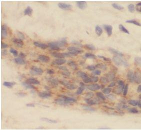 anti- IL-19 antibody