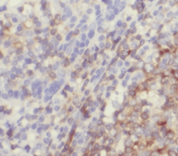 anti- IL-19 antibody