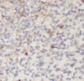 anti- IL33 antibody