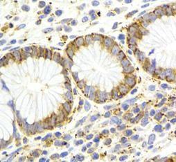 anti- KISS1R-Specific antibody