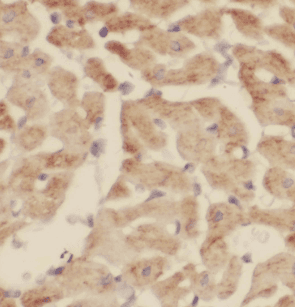 anti- LTB4R antibody