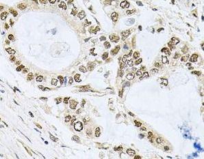 anti- MCL1 antibody