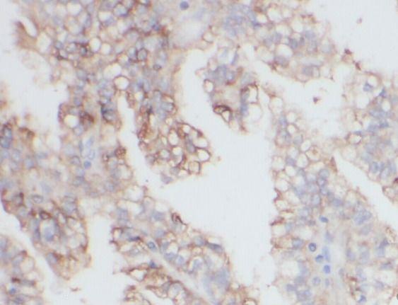 anti- MME,CD10 antibody