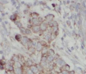 anti- MMP2 antibody