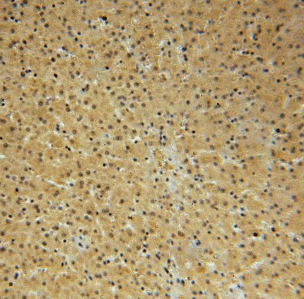 anti- NAP1L4 antibody