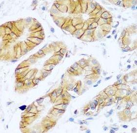 anti- NCAM1/CD56 antibody