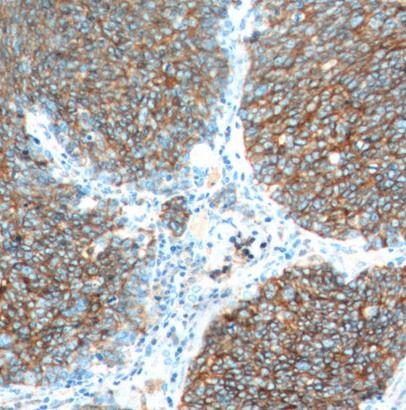 anti- NCAM1/CD56 antibody