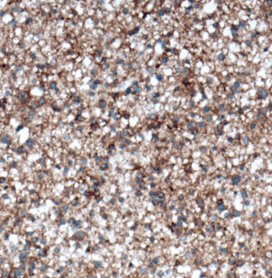 anti- NCAM2 antibody