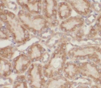 anti- NR3C2 antibody