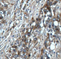 anti- NT5E/CD73 antibody