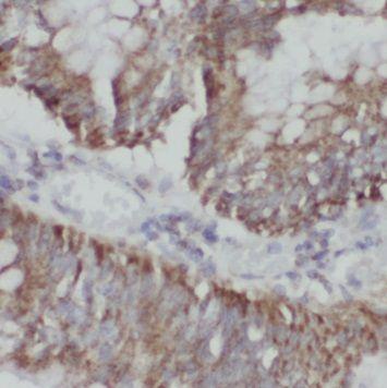 anti- NUP133 antibody