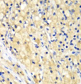 anti- NUP62 antibody