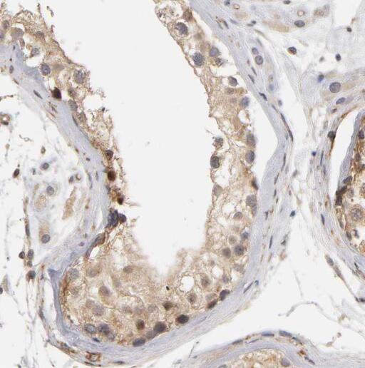 anti- OSBPL9 antibody