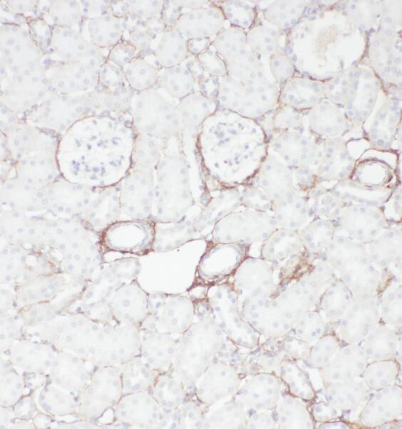 anti- OXER1 antibody