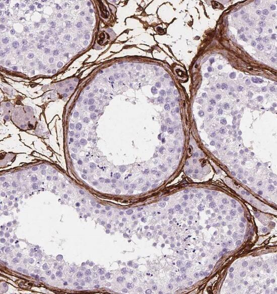 anti- P2RY1 antibody