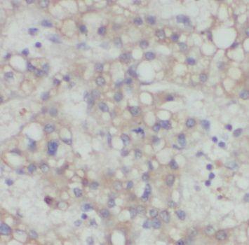 anti- PDGFRL antibody