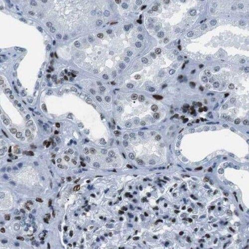 anti- PHF14 antibody