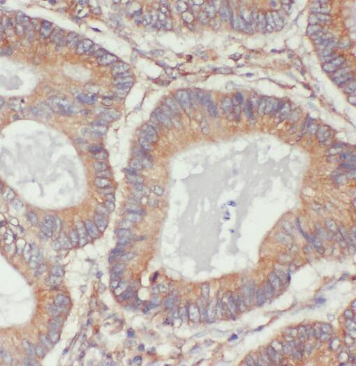 anti- PKM antibody