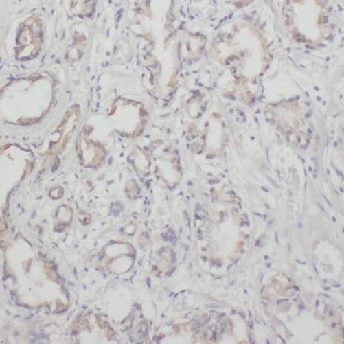 anti- PVRL3, Nectin 3 antibody