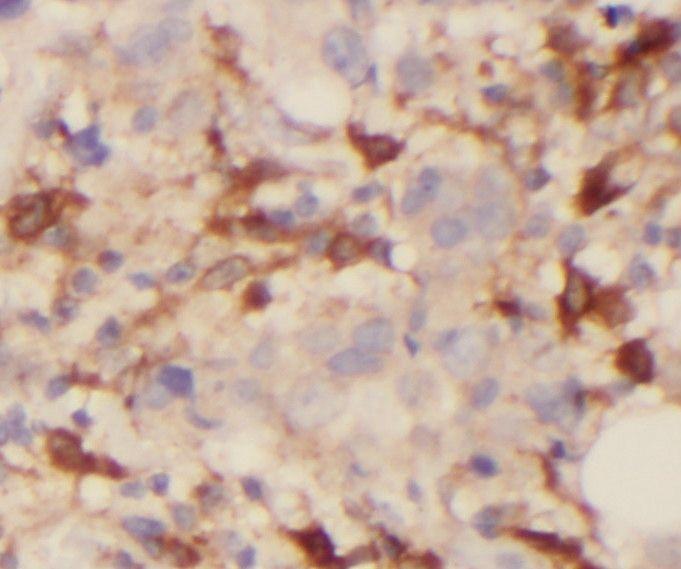 anti- ROR1 antibody