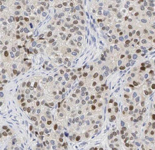 anti- Sam68 antibody