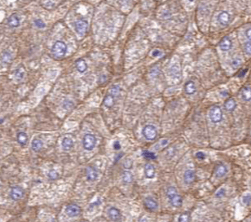 anti- SERPINA10 antibody