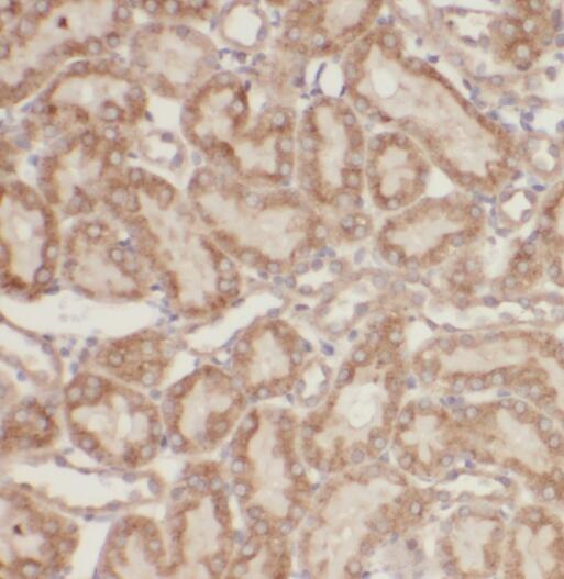 anti- SERPINA6 antibody