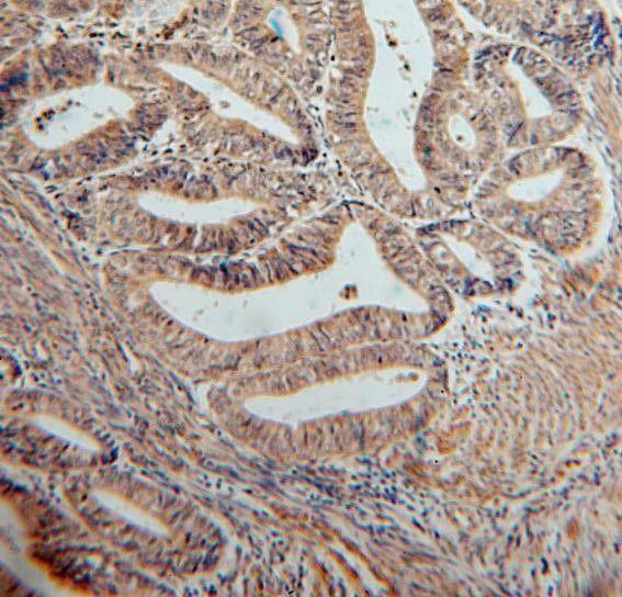 anti- SERPINB2 antibody