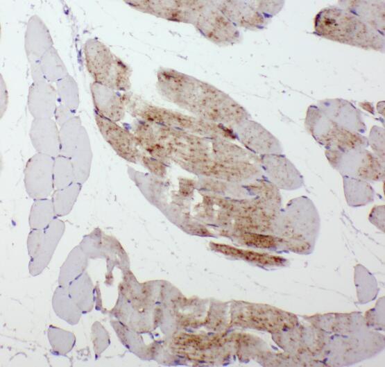 anti- SERPINB6 antibody