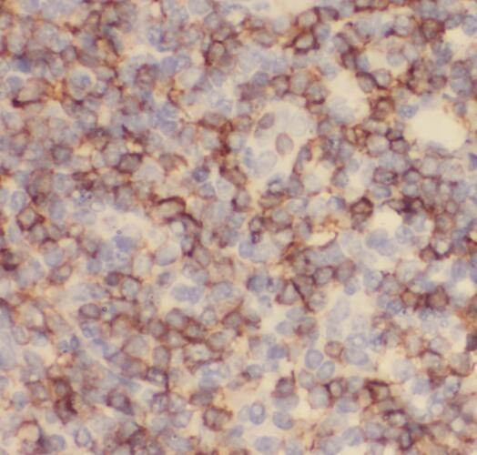 anti- SERPING1 antibody