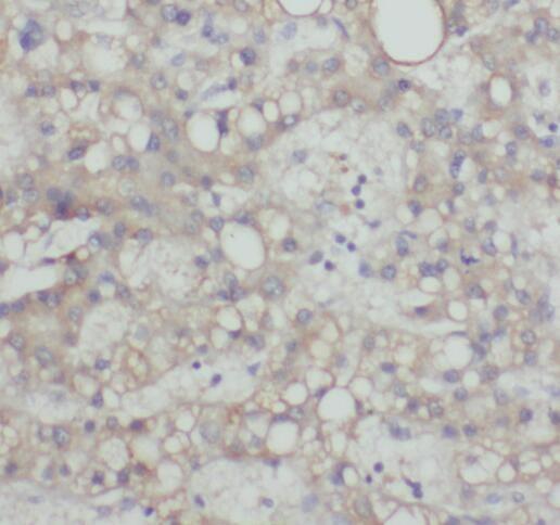 anti- SIGLEC9 antibody