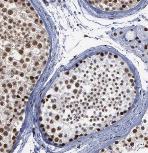 anti- SIRT1 antibody