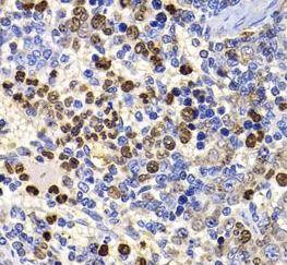 anti- UBASH3B/STS 1 antibody