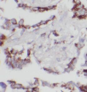 anti- UBXN11 antibody