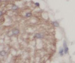 anti- UCP1 antibody
