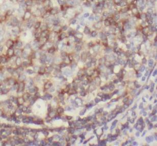 anti- CD151 antibody