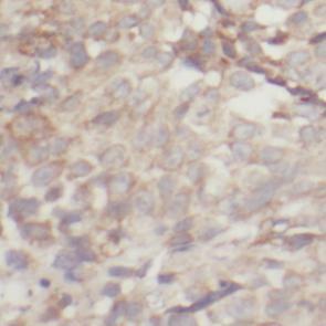 anti- AKT1S1 antibody