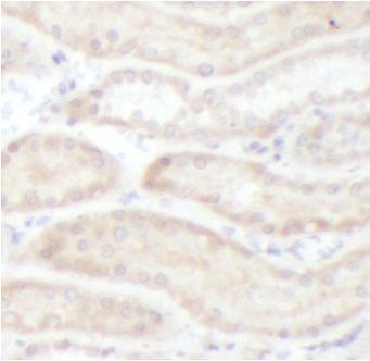 anti- FZD4 antibody